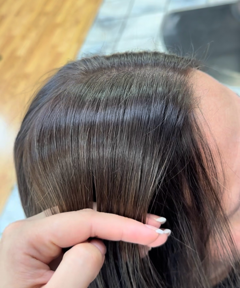 Root Retouch
