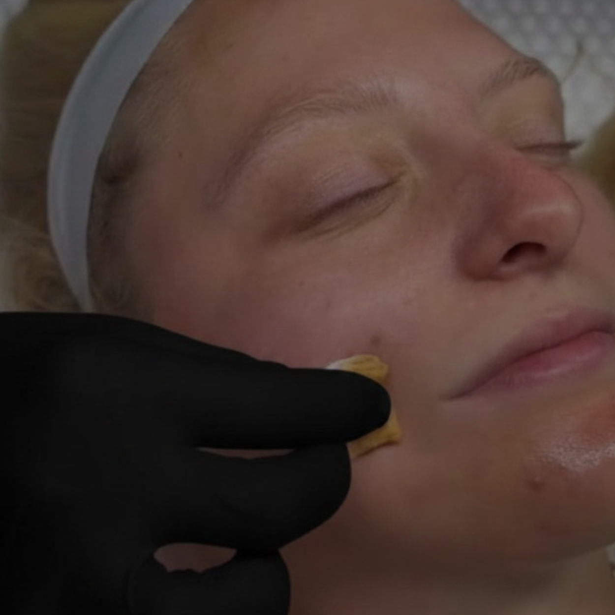 Dermal Renewal Facial at Aura Haus in Owensboro, KY