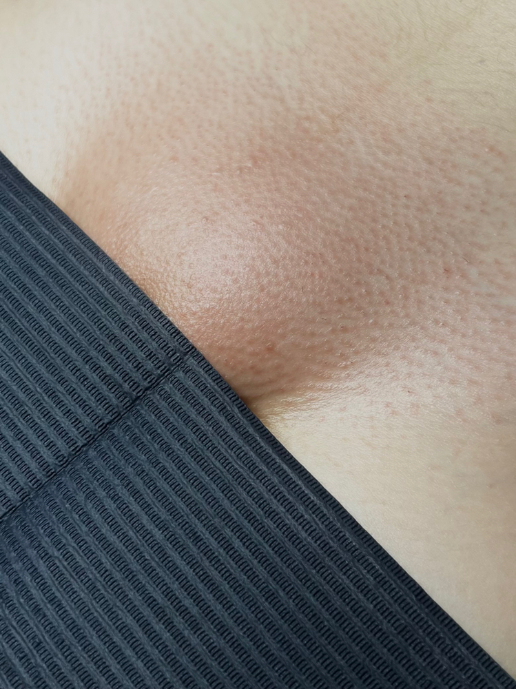 Brazilian Wax