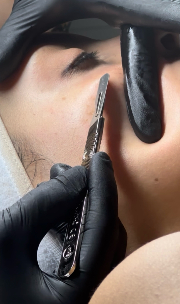 Dermaplaning Add-On