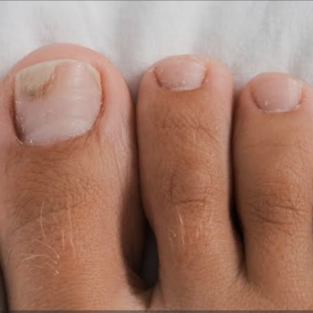 Antifungal Pedicure Nails Only at Chicago's Favorite Nail Spa in Lansing, IL