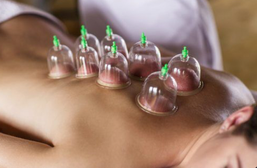 Therapeutic Cupping Massage at LuxBeautique in Pawtucket, RI