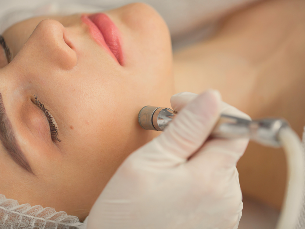 Diamond Tip Microdermabras Facial at Dahlias Wellness Center in passaic, NJ