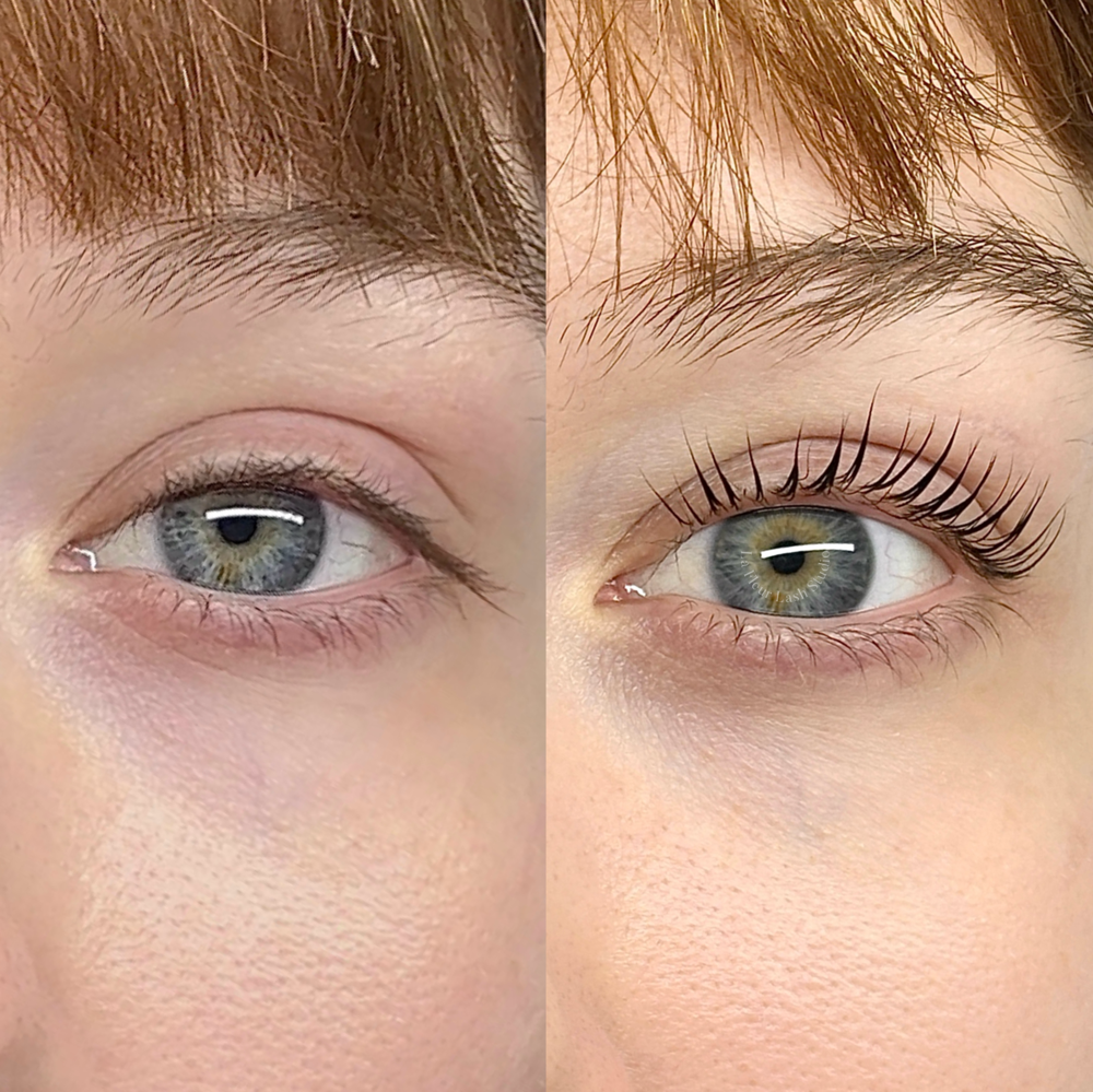 Lash Lift