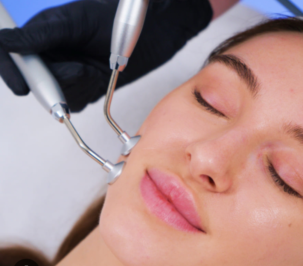 Post-Acne Scar treatment