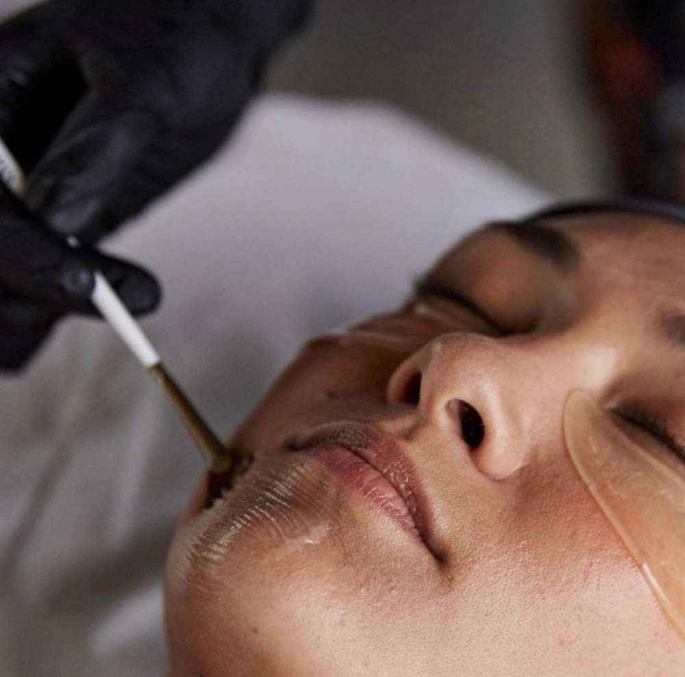 Chemical Peel