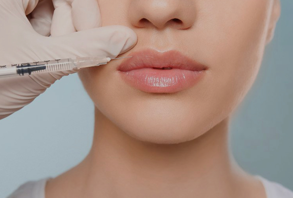 Dermal Filler