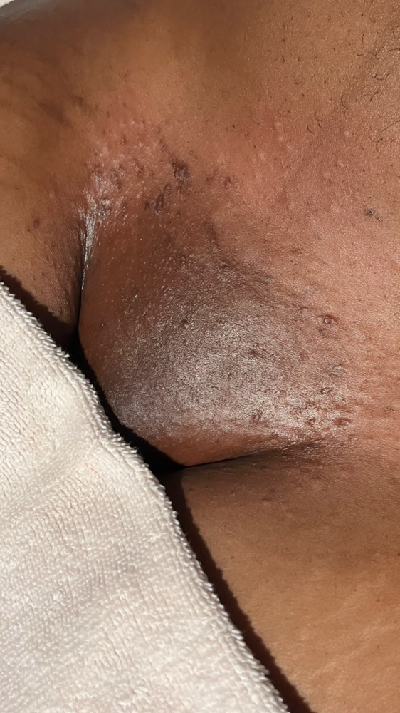 Brazilian Wax at Waxing Moon Mobile Esthetics in Saint Cloud, FL