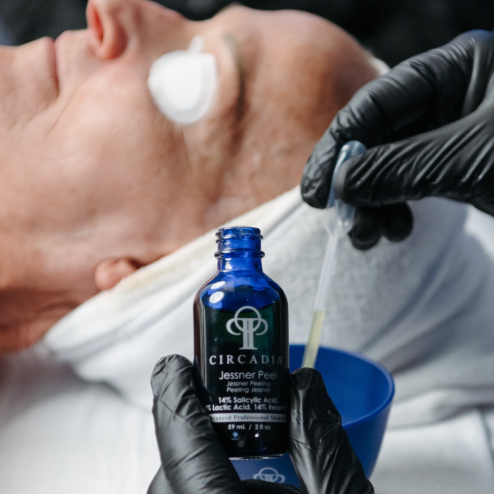 Level 2 Chemical Peel at Elevate Aesthetics in Sandy, UT