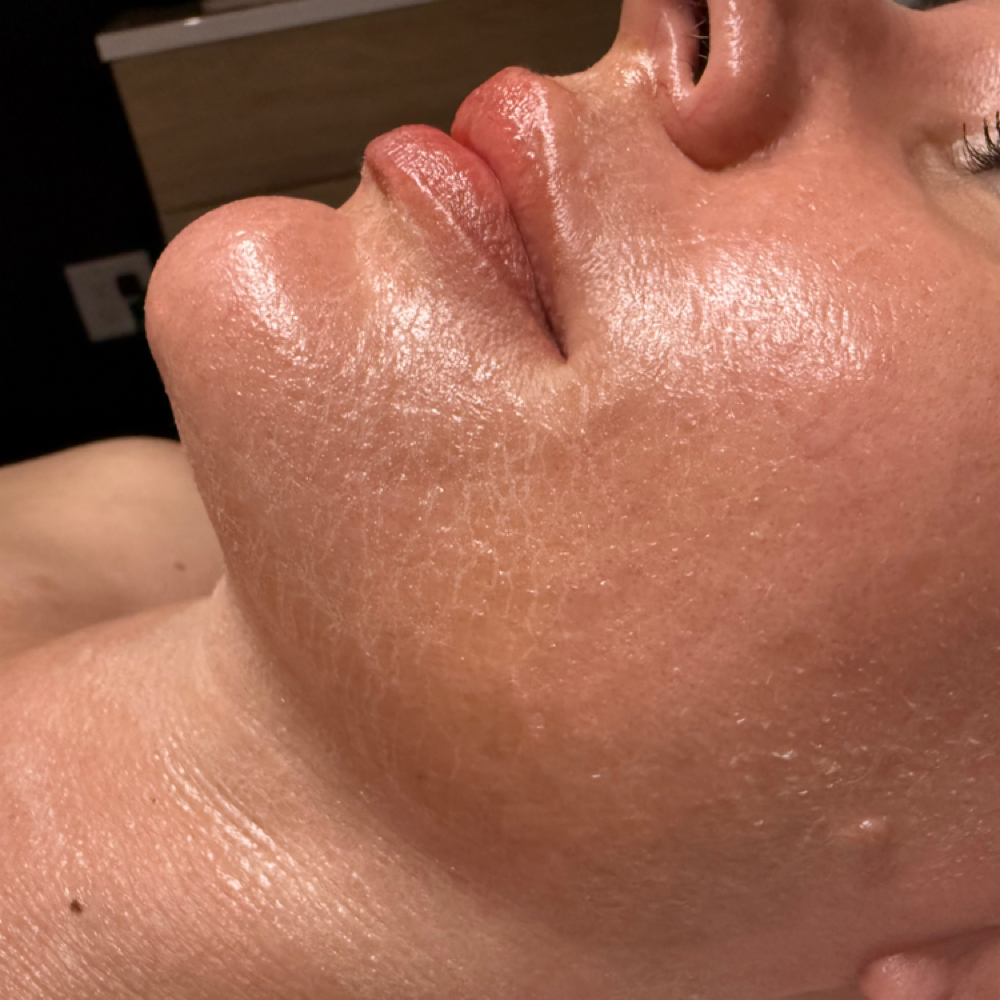 Peptide Infusion mask Add on at The Nice Needle and Spa in Prosper, TX