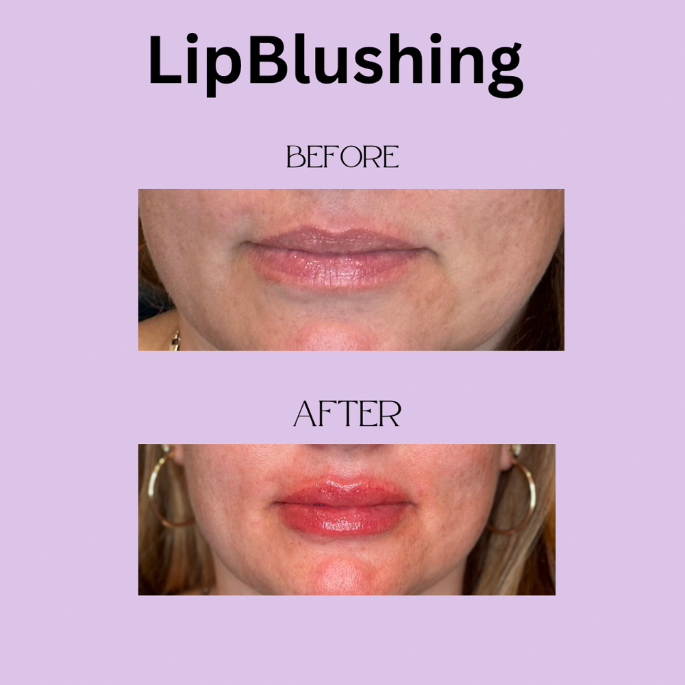 Lifetime Touch Up(Lips)