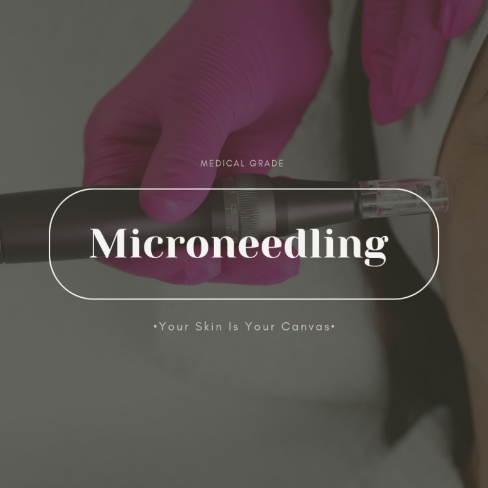 Microneedling (MEDICAL GRADE) at Face Palette Aesthetics in Franklin, WI