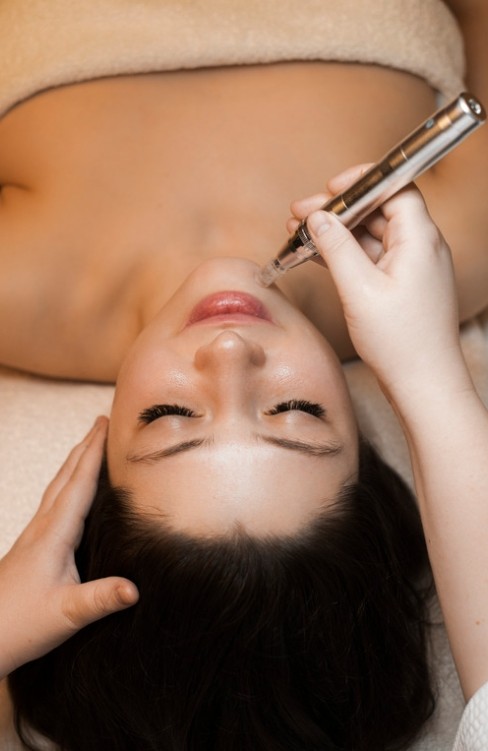 MicroCollagen Induction Therapy