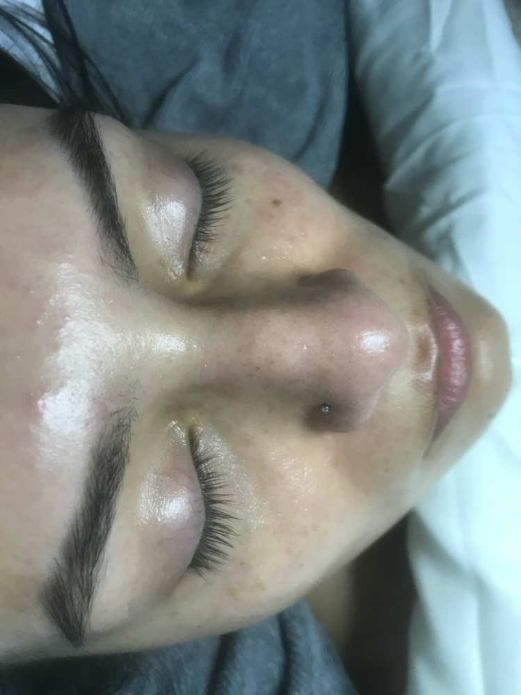Nano Infusion W/ Dermaplan Facial