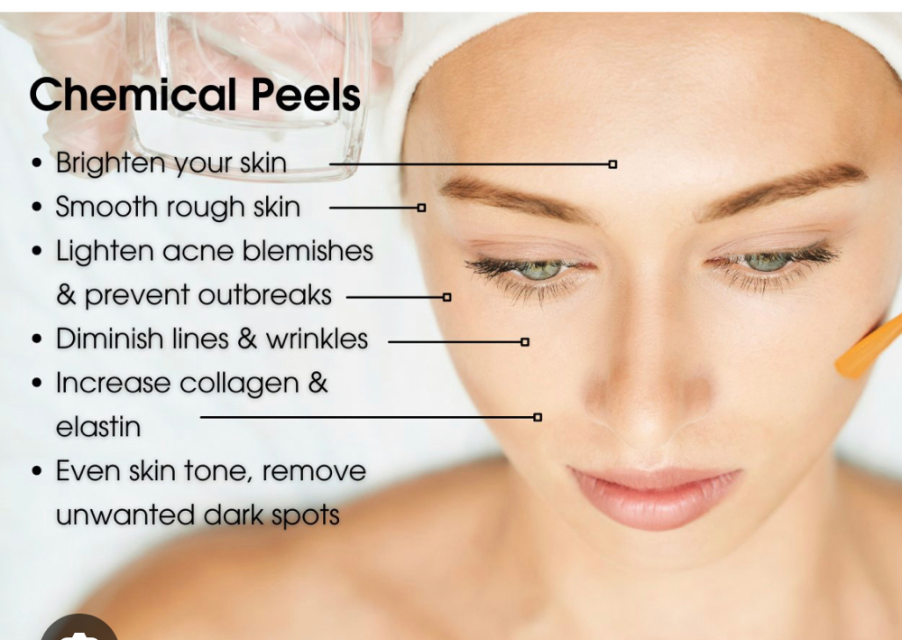 Chemical Peels