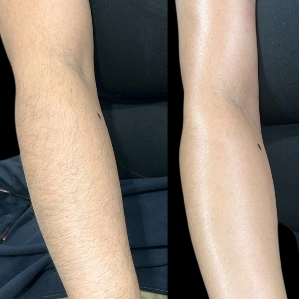 Full Arm Wax at Envious Smiles & Beauty in Rockford, IL
