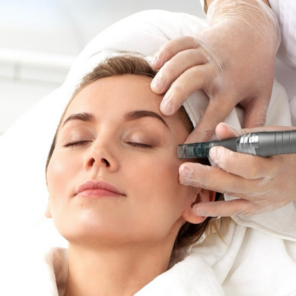PRP Microneedling - 3 Session at Happy Feet & Aesthetics in Plainview, TX