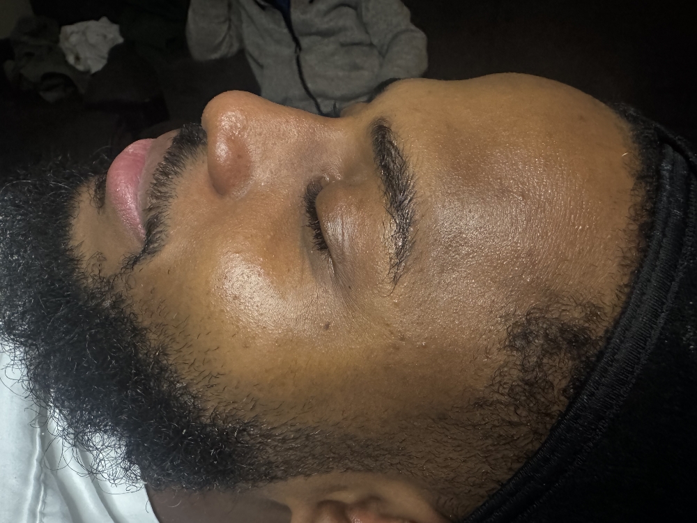 Renewal Facial