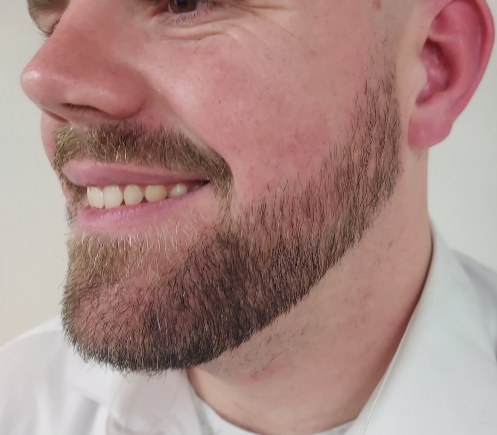 Beard Trim