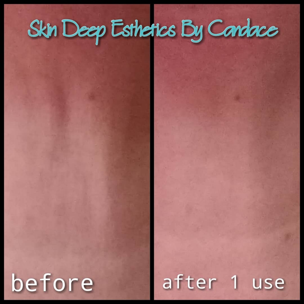 Firming Neck Treatment