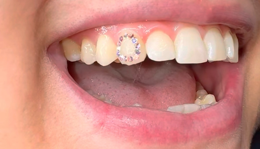 Tooth Outline at TooTheeMaxx in Lindenhurst, NY