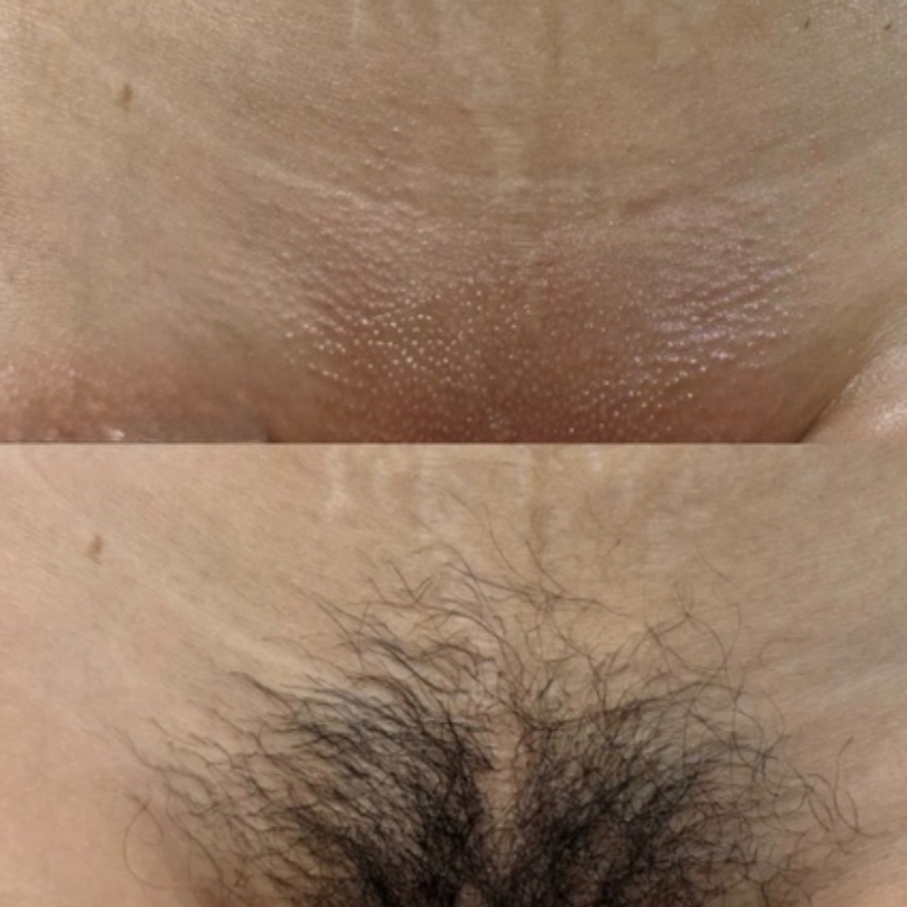 Brazilian wax at Sunshine Glow in Belleville, NJ