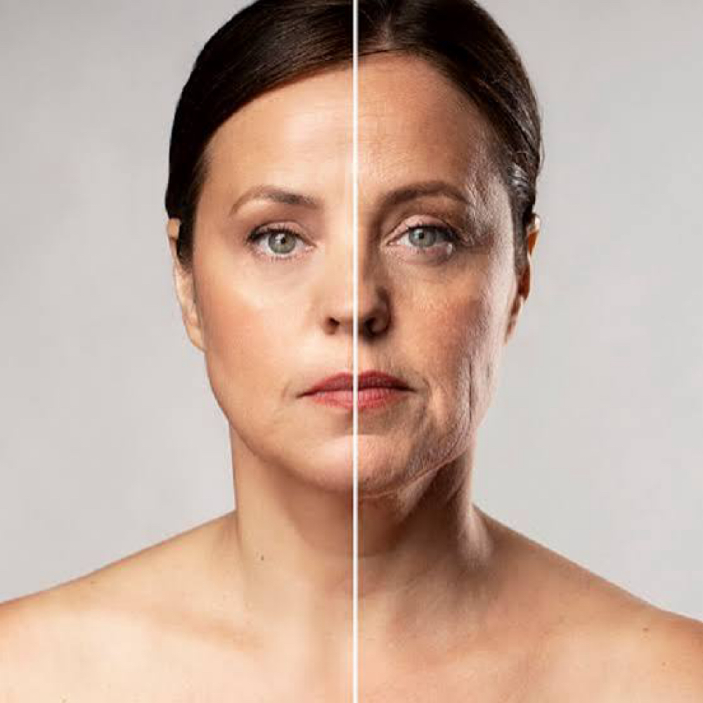 LiftFX at Sculpting Beauty by Pam LLC in Atascocita, TX