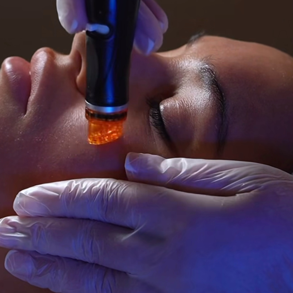 HydroFacial + Dermaplane COMBO