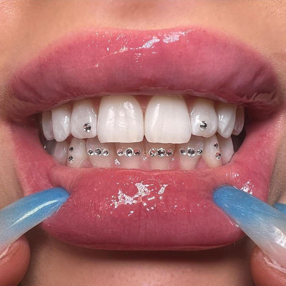 Tooth Gem