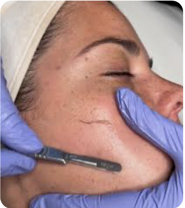 Dermaplaning Add On