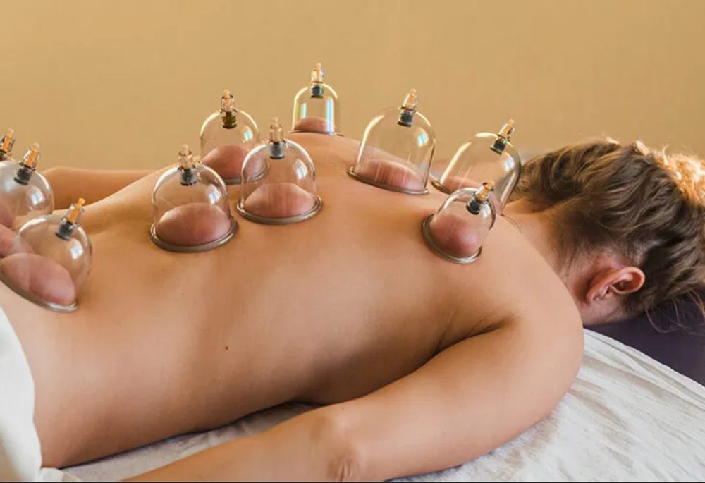 Cupping Therapy (Add On)