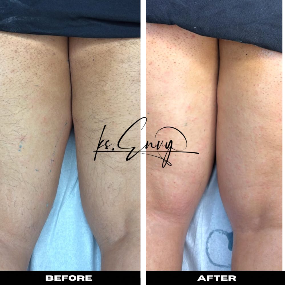 Leg: Upper at KS.Envy in Columbus, OH