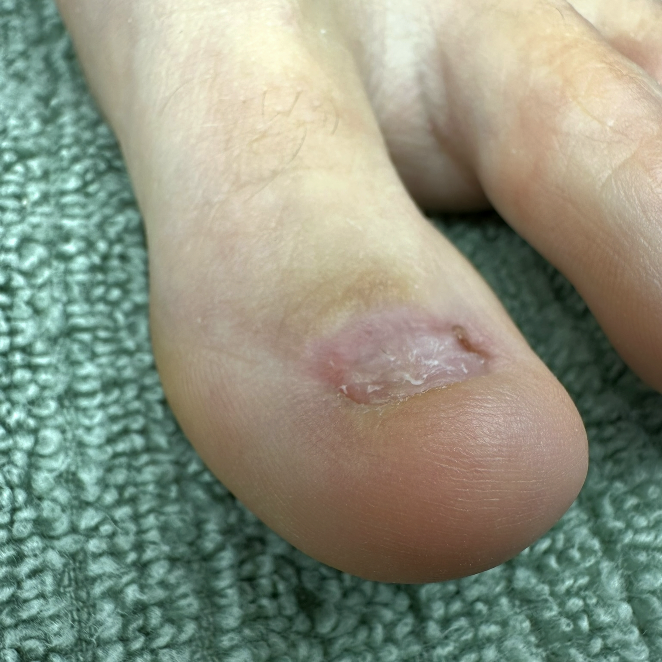 Aesthetic Nail Plate Formation