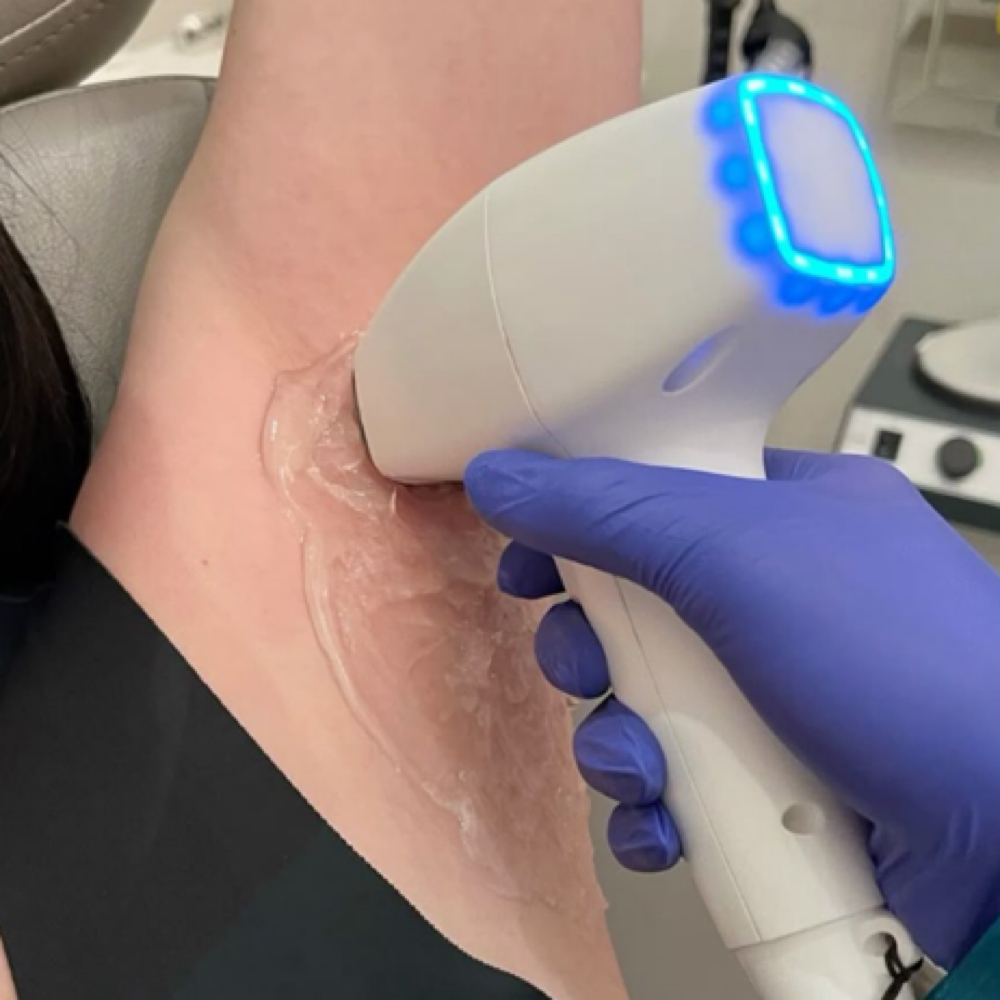 Armpits Hair Removal (8 Sessions) at Nenusk Aesthetics in Long Island City, NY