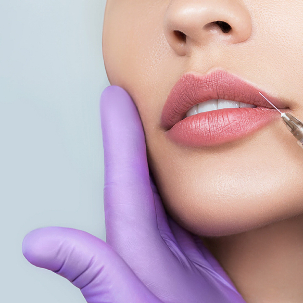 Lip Flip at Refyned Aesthetics & Wellness in Greenville, TX