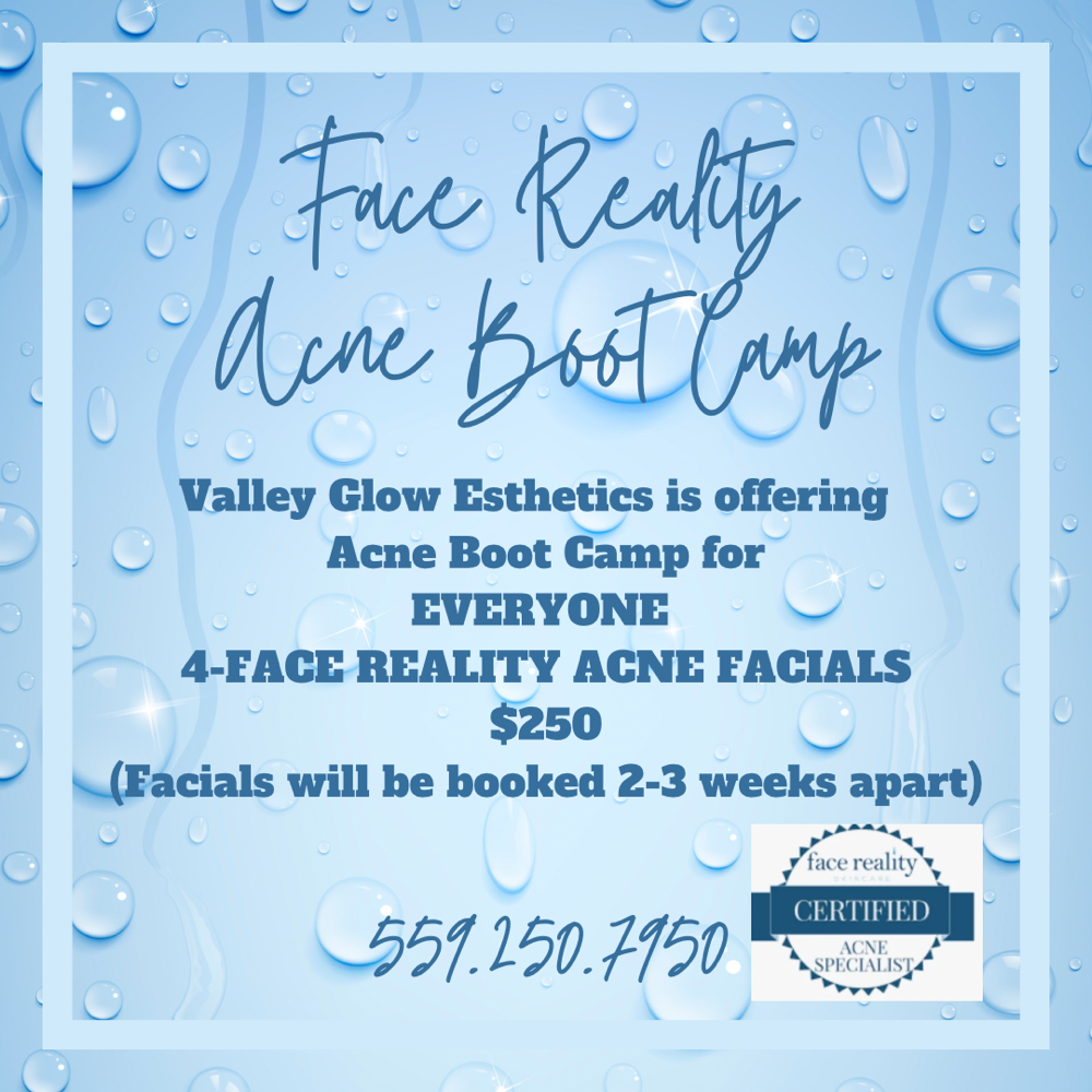 Face Reality Acne Bootcamp (4 Pack)