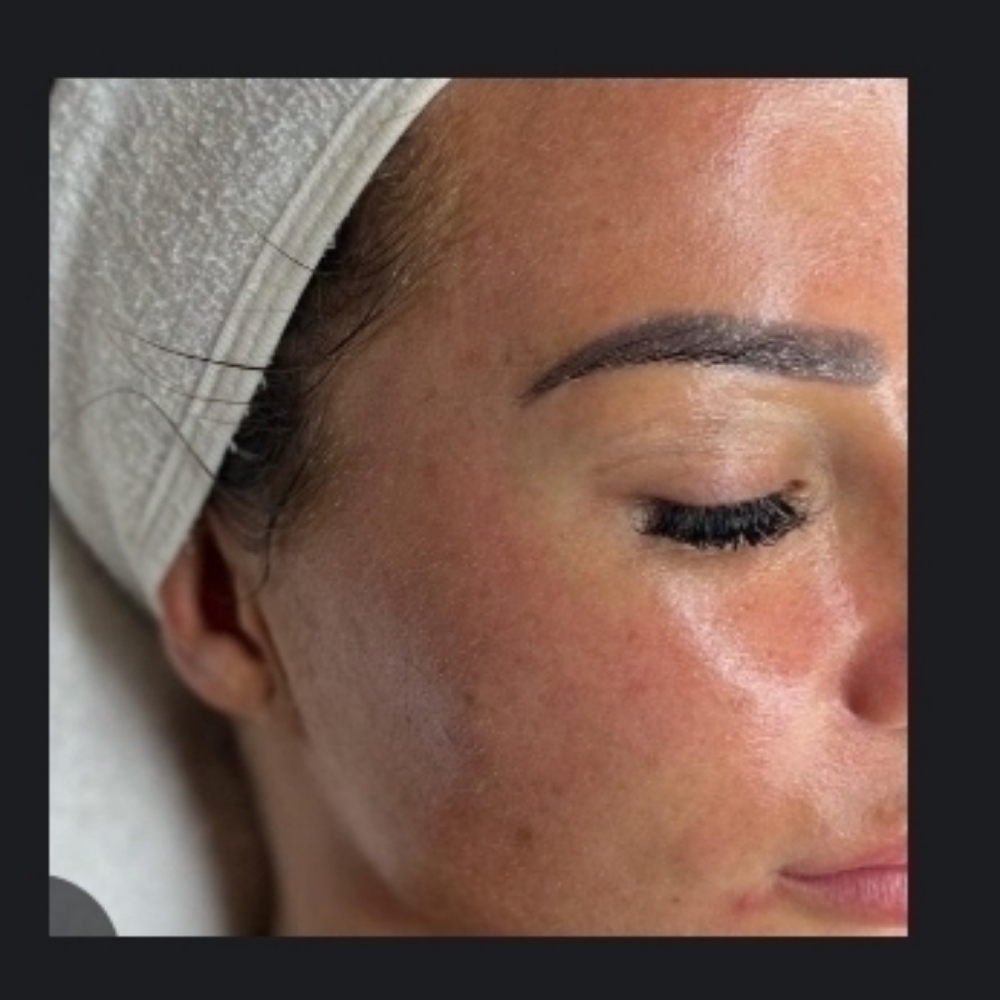 Tox Facial for Glass Skin Look at Skin & Toxx Medical Spa Westchase in Houston, TX