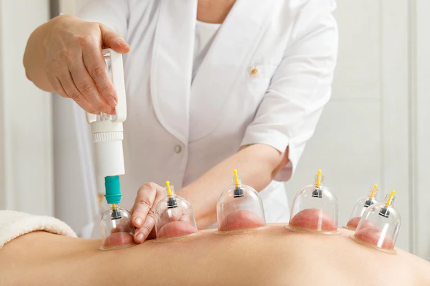 Cupping Massage- 90min