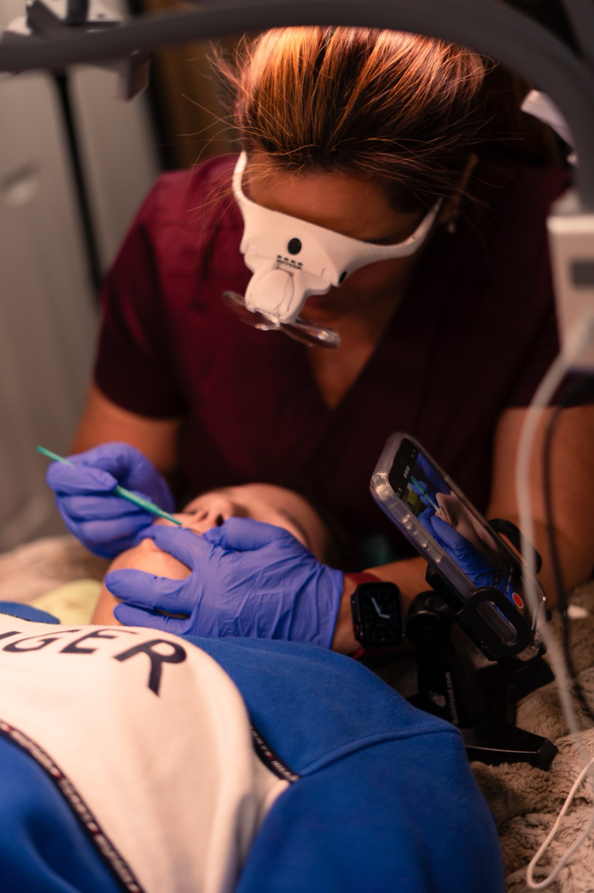 Dermaplaning