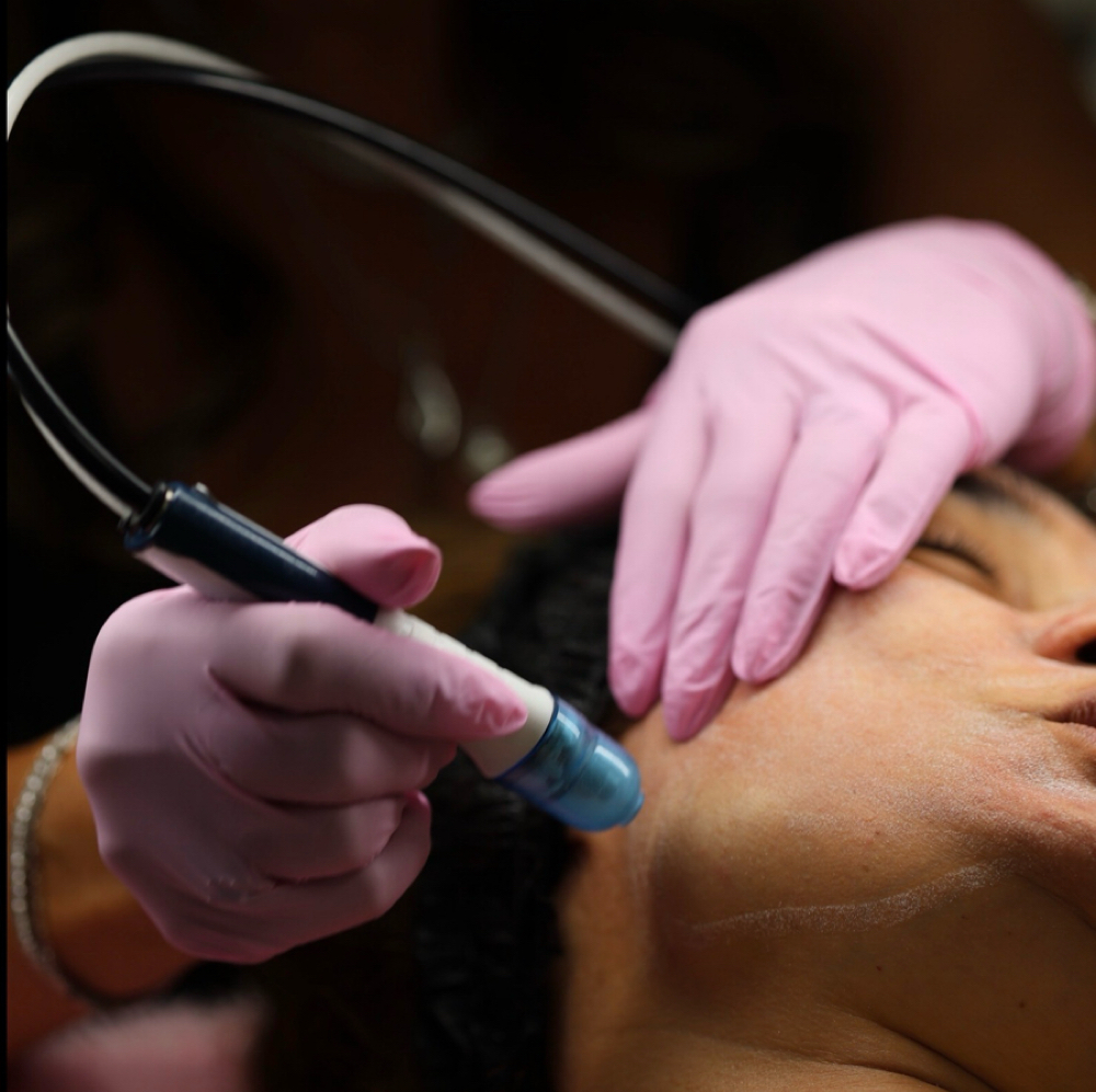 Microdermabrasion Package of 6 at Skin Studio 57 in Woburn, MA