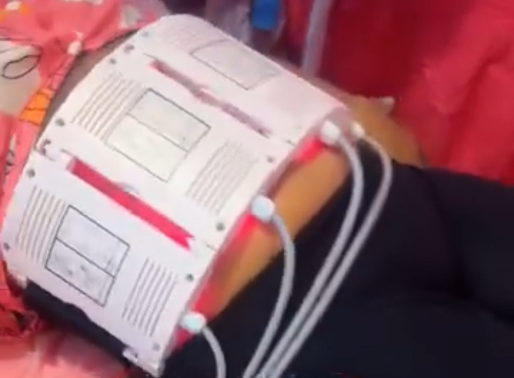 Lipo Laser
