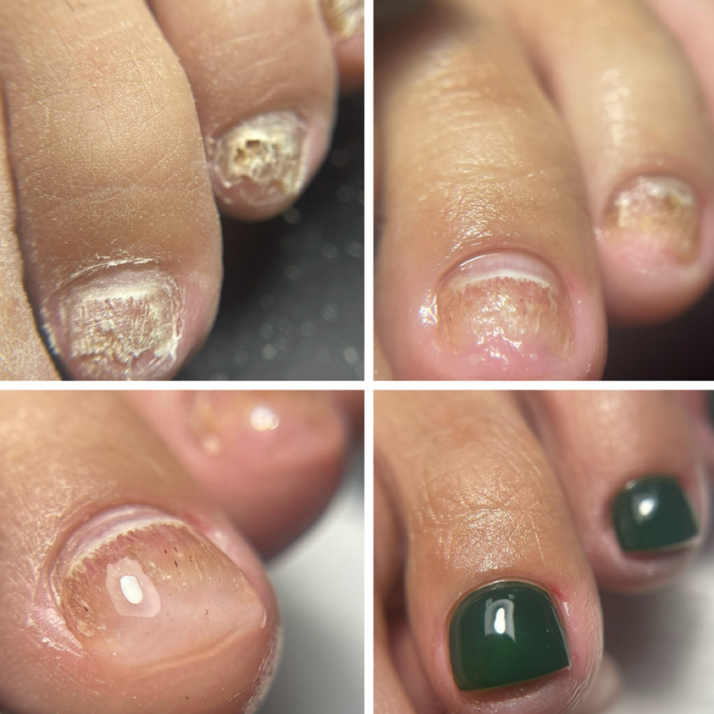 Nanoflex Treatment at Jaleisha’s Nail Salón & Spa in Vega Alta, PR