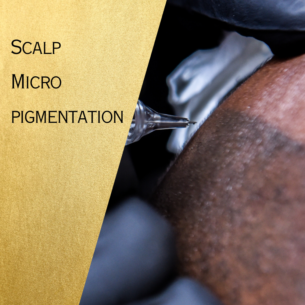 Womens Scalp Micropigmentation