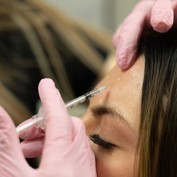 Botox injections at Fade + Form Skin Aesthetics in Cartersville, GA