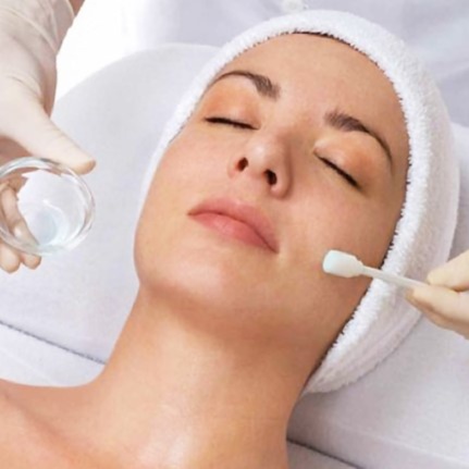 Chemical peel at Aesthetic Artistry by Renee V in Roswell, NM