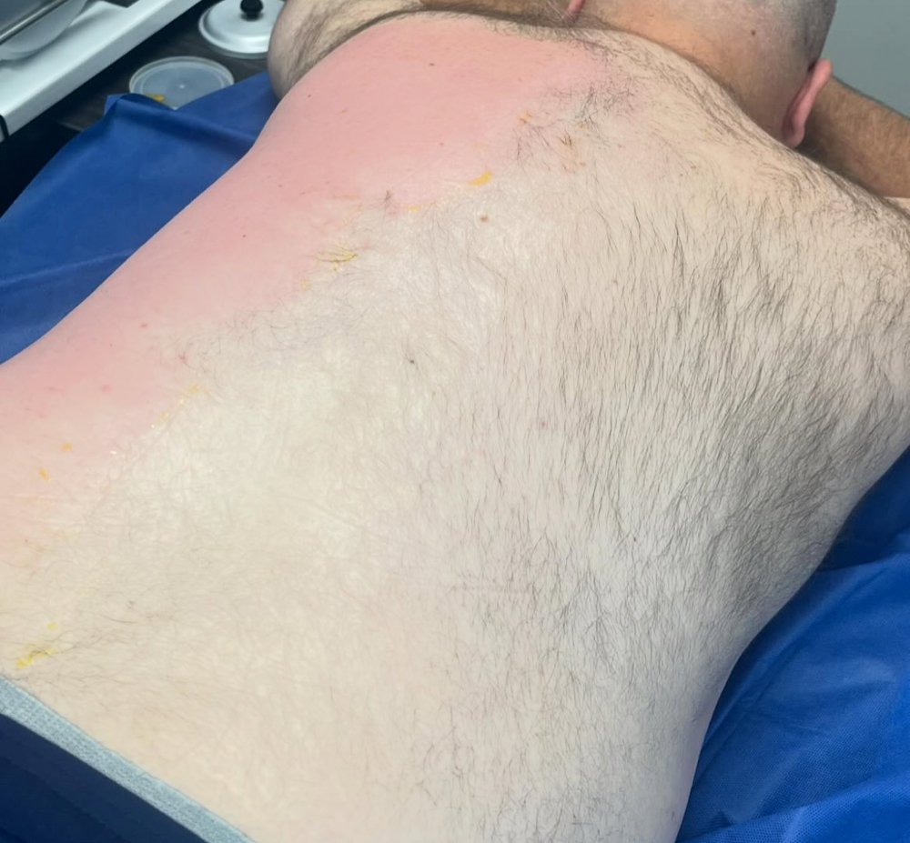 Men’s Full Back Wax