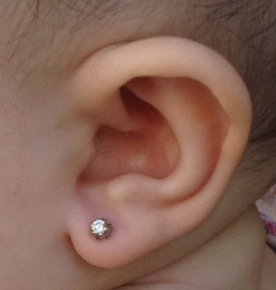 Minor Double Lobe Piercing
