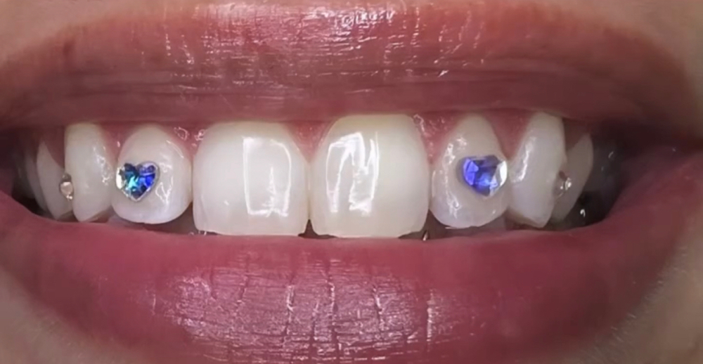 Heart Shape Tooth Gem Set