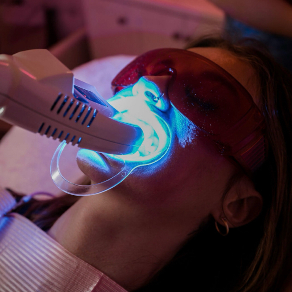 Teeth Whitening at Lady Mae Esthetic’s in Redmond, OR