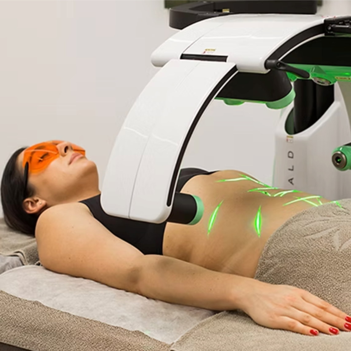 6D Emerald Laser at Finer Beauty Spa in Bronx, NY
